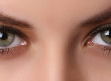 Blefaroplastia