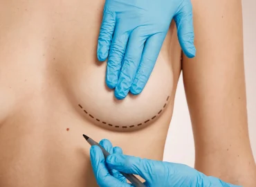 Aumento de pecho seguro: consejos, cuidados y recomendaciones profesionales