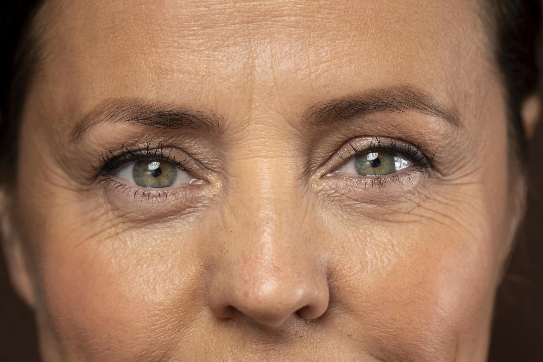 Cómo mejorar las bolsas en los ojos: tratamientos con y sin cirugía en Bilbao